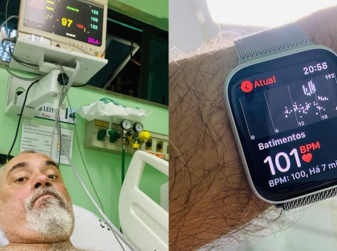 Image article Une Apple Watch sauve un Brésilien suite à un rythme cardiaque élevé
