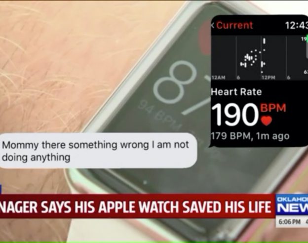 Apple Watch Sauve Adolescent Tachycardie Supraventriculaire