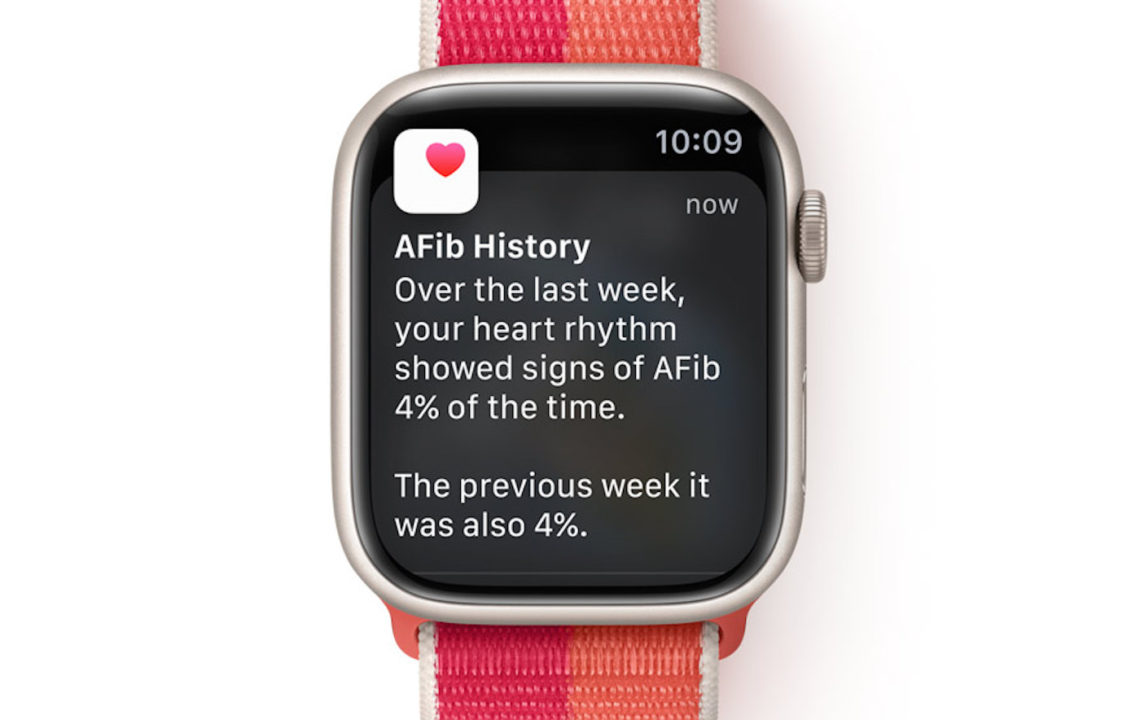 Apple Watch watchOS 9 AFib Historique de Fibrillation Auriculaire