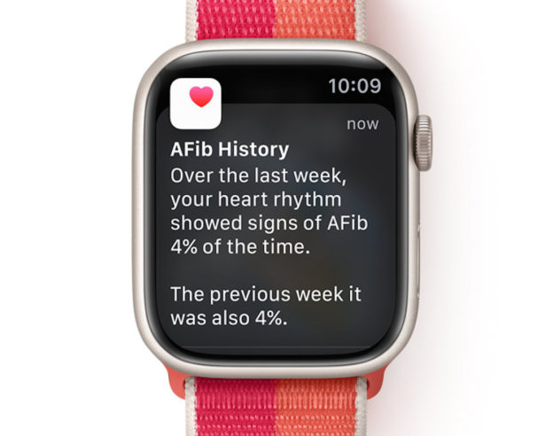 Apple Watch watchOS 9 AFib Historique de Fibrillation Auriculaire