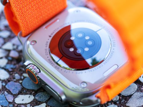 Image article Apple Watch : la FDA s’oppose aux capteurs de glycémie sur les montres connectées