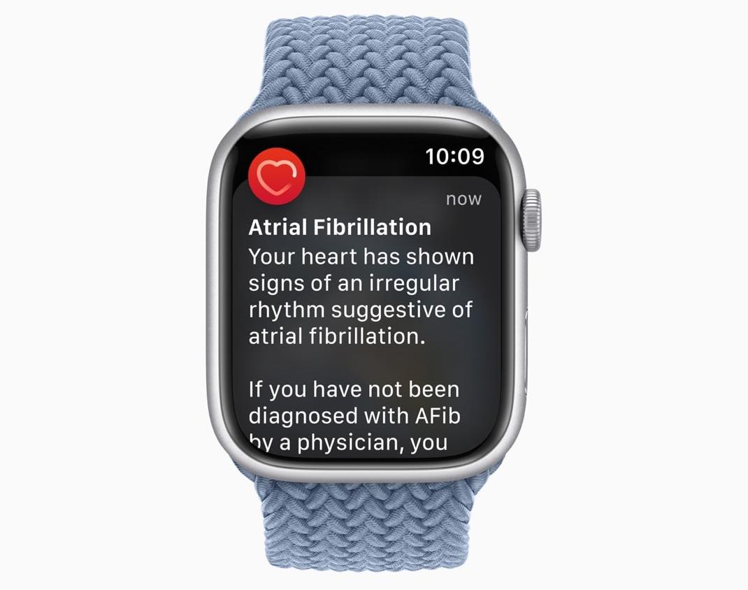 L’Apple Watch sauve la vie d’un Texan touché par une violente fibrillation