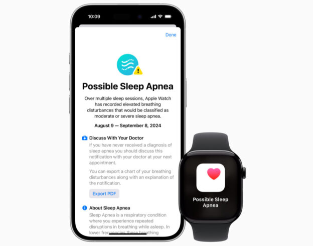 Image Apple Watch : la détection de l’apnée du sommeil est disponible en France