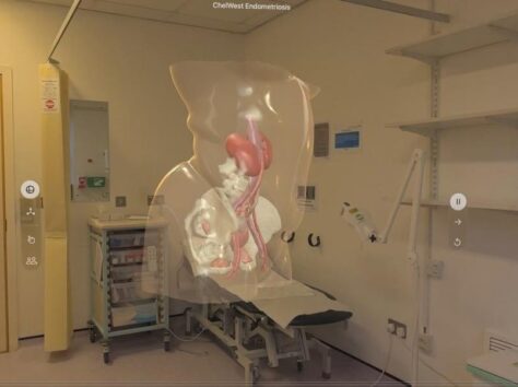 Image article À Londres, l’Apple Vision Pro aide désormais les patients à visualiser leur opération avant d’entrer au bloc