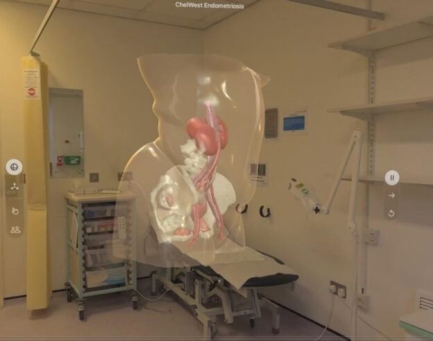 Image À Londres, l’Apple Vision Pro aide désormais les patients à visualiser leur opération avant d’entrer au bloc