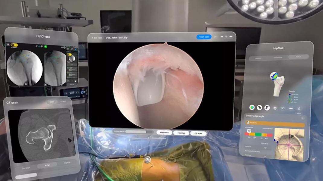 Vision Pro Stryker chirurgie